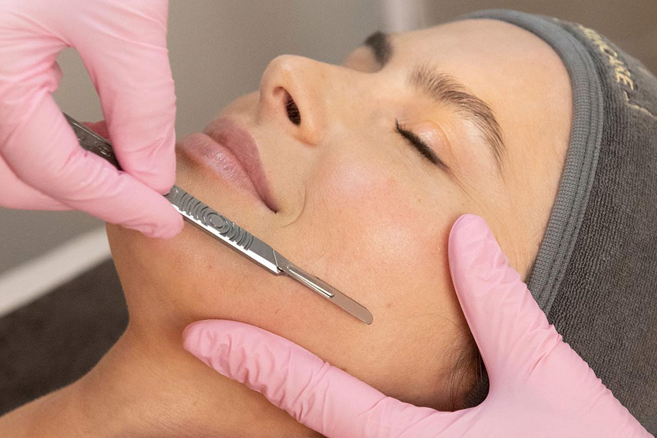 Dermaplaning at Avé Aesthetics in Queens NY