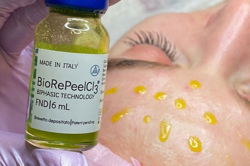 Microneedling at Avé Aesthetics in Queens NY