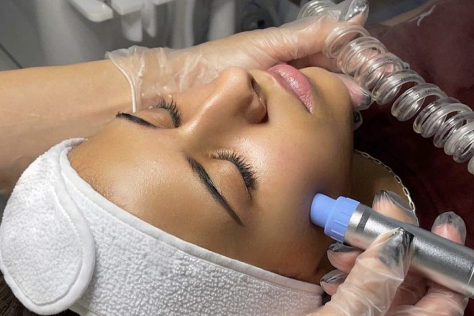 Hydrodermabrasion at Avé Aesthetics in Queens NY