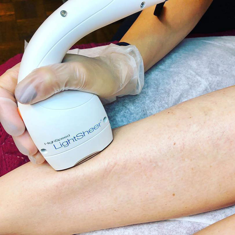 Laser treatments Avé Aesthetics in Queens NY